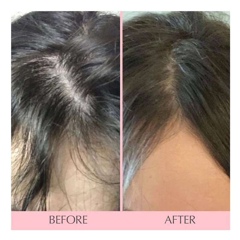 Hairtamin Mom 30 Vegan Capsules Best Price in Dubai